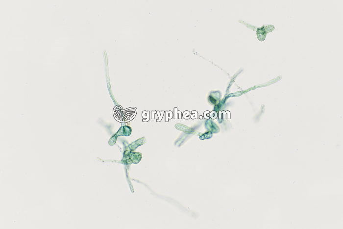 Protonémas de Mousse - gryphea.com